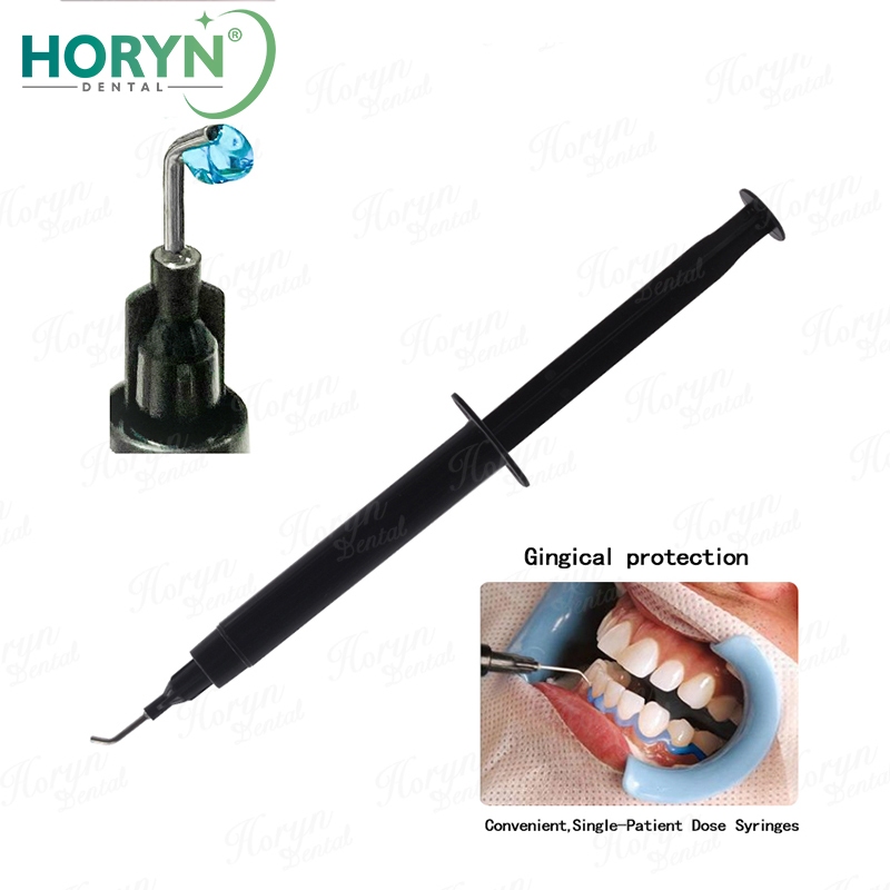 Teeth Whitening Results - Horyn Dental Gingival Isolation Barrier Gel