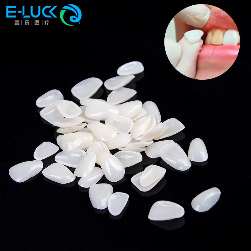 Teeth Whitening Veneers - 50pcs Dental Teeth Veneers Temporary Crown