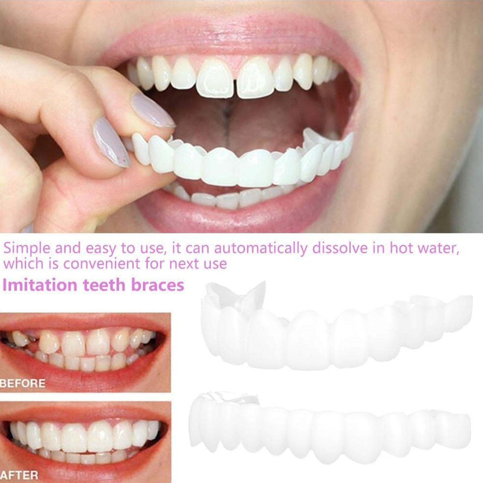 Teeth Whitening Veneers - 2pcs Men Women Temporary Teeth Veneers