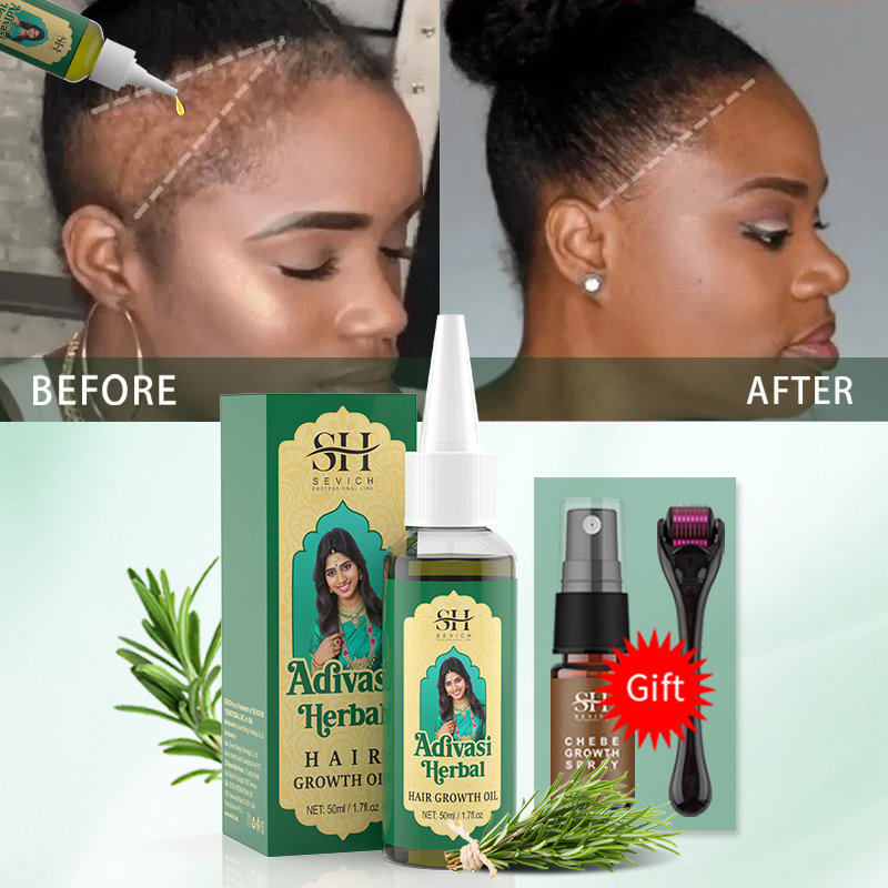 Ayurvedic Hair Growth Oil Indi - огляд і ціна Coconut Oil Pull