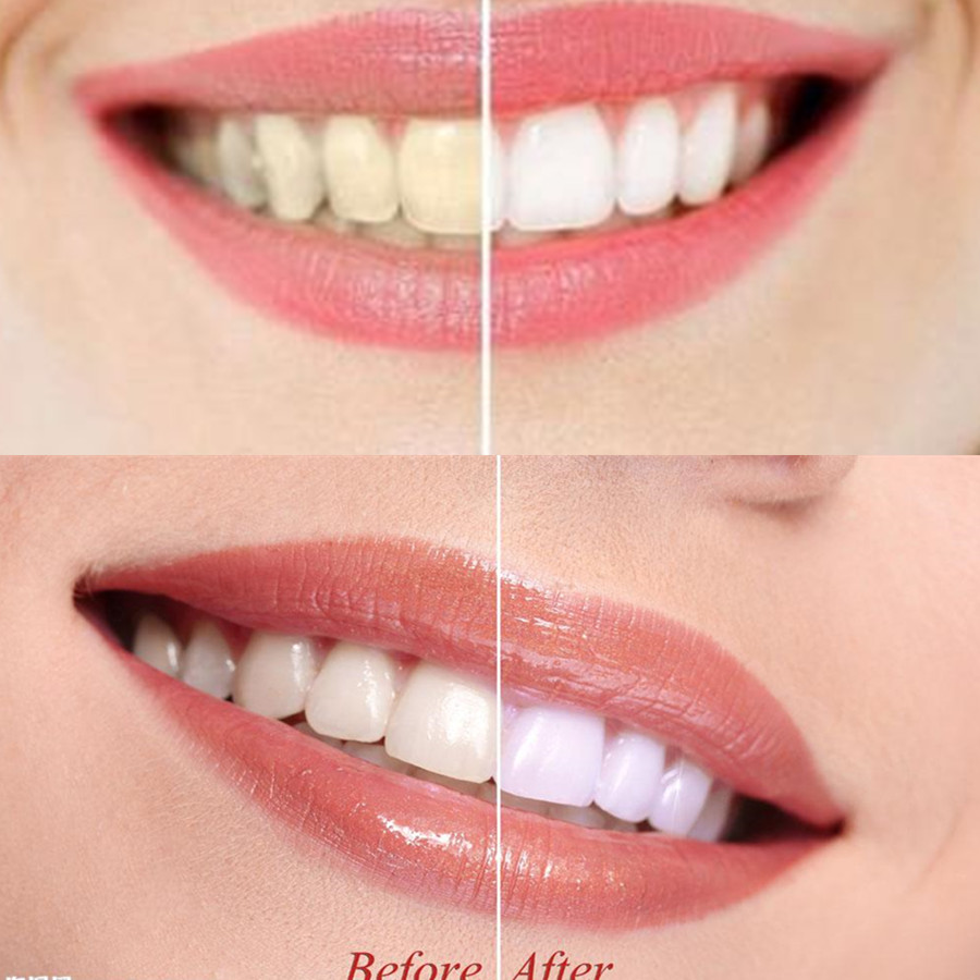 Bamboo Charcoal Teeth Tooth De - огляд і ціна Teeth Whitening Results
