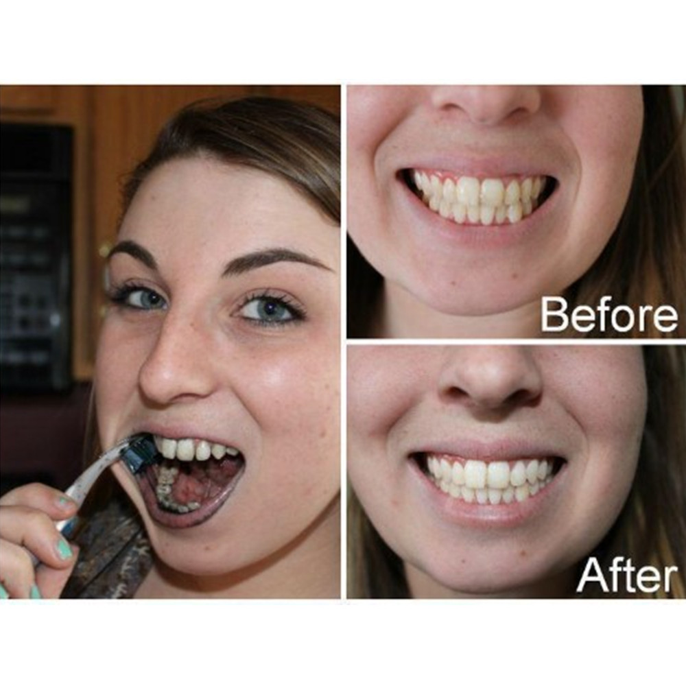 Bamboo Charcoal Teeth Tooth De - огляд і ціна Teeth Whitening Results