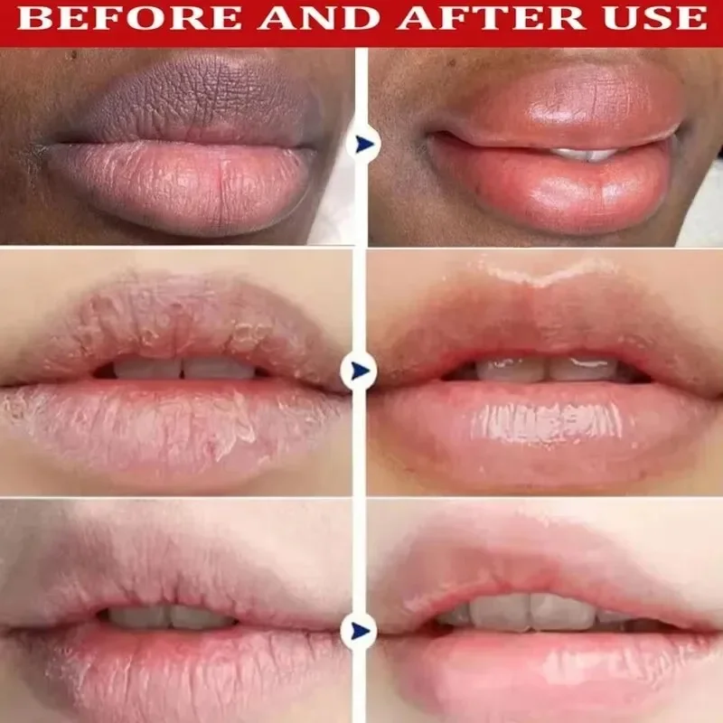 Remove Dark Lip Balm Lightenin - огляд і ціна Coconut Oil Pull