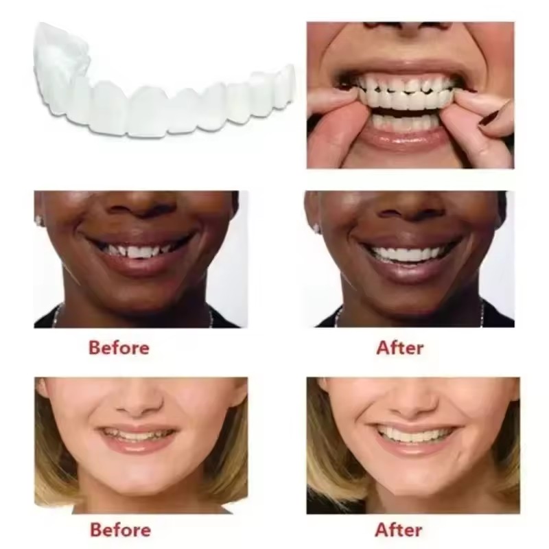 Teeth Veneers Whitening Dentur - огляд і ціна Teeth Whitening Veneers
