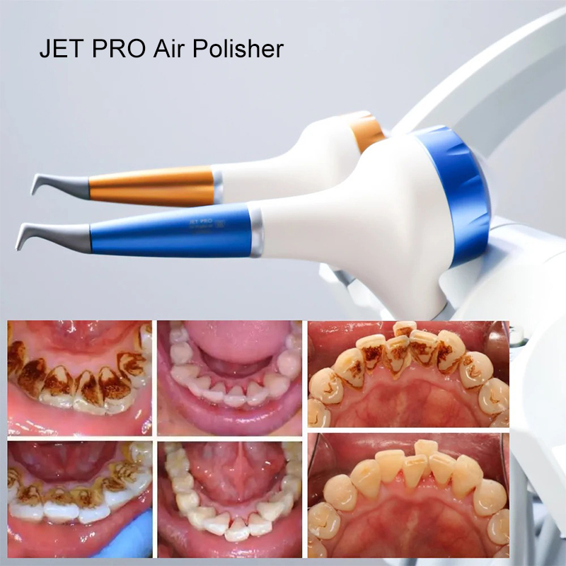 VV Dental  Air Polishing Proph - огляд і ціна Teeth Whitening Usa