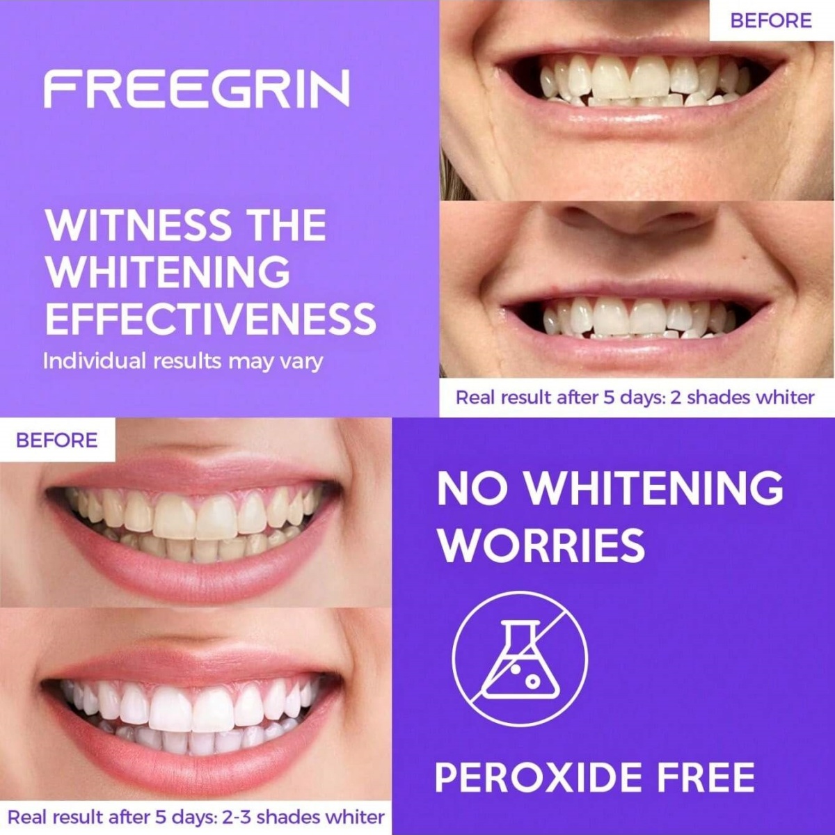 Deluxe Whitening Teeth Sticker - огляд і ціна Teeth Whitening Results