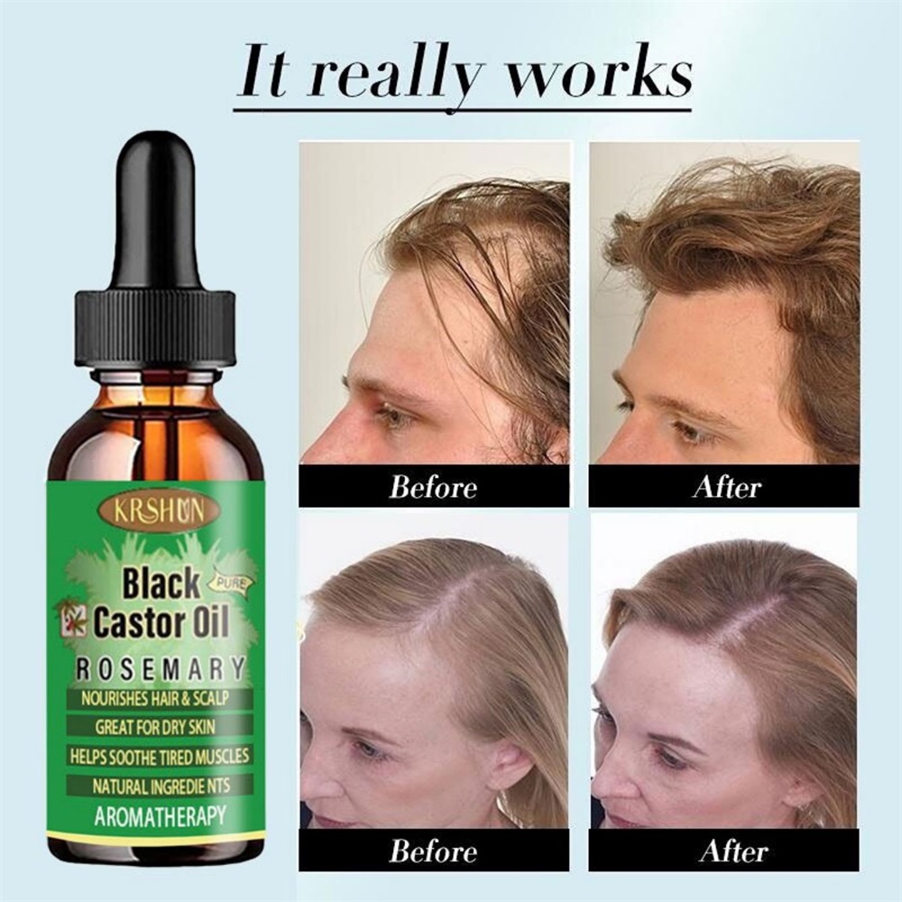 Black Castor Oil Nourishes Hai - огляд і ціна Coconut Oil Pull