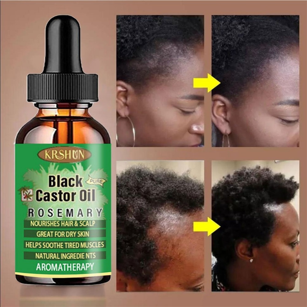 Black Castor Oil Nourishes Hai - огляд і ціна Coconut Oil Pull