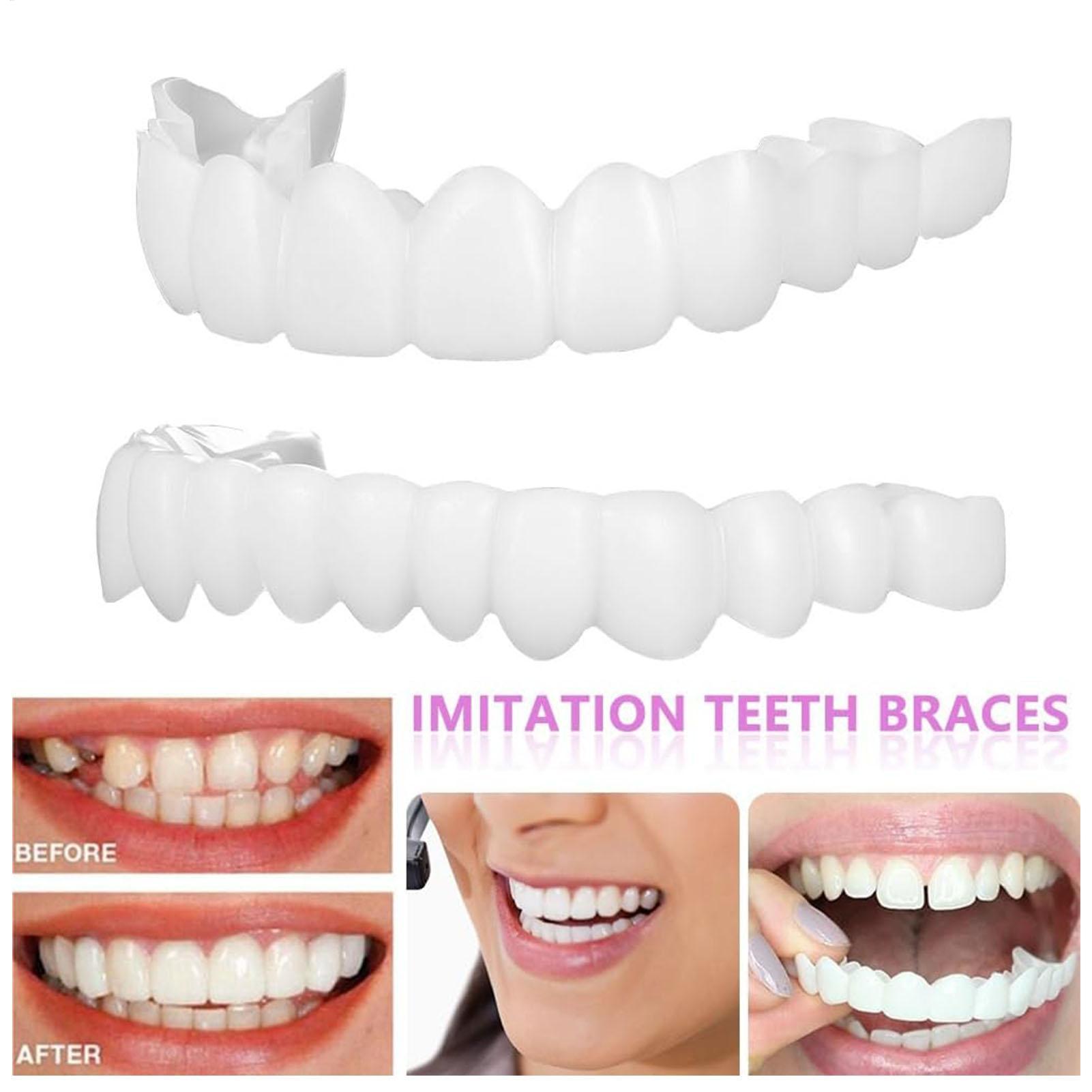 2pcs Men Women Temporary Teeth - огляд і ціна Teeth Whitening Veneers