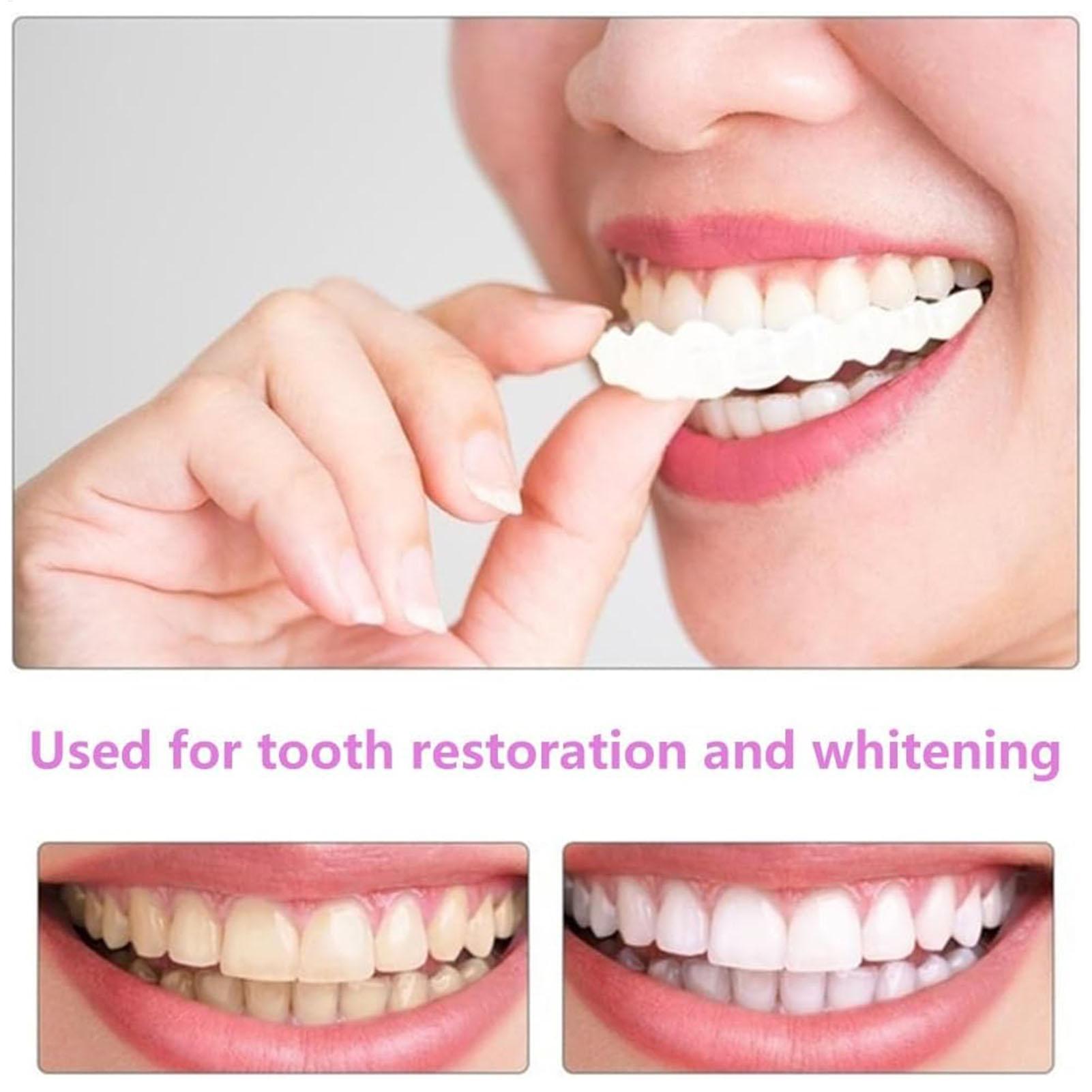 2pcs Men Women Temporary Teeth - огляд і ціна Teeth Whitening Veneers