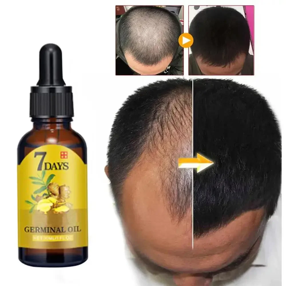 Hair Growth Ginger Fast Growin - огляд і ціна Coconut Oil Pull