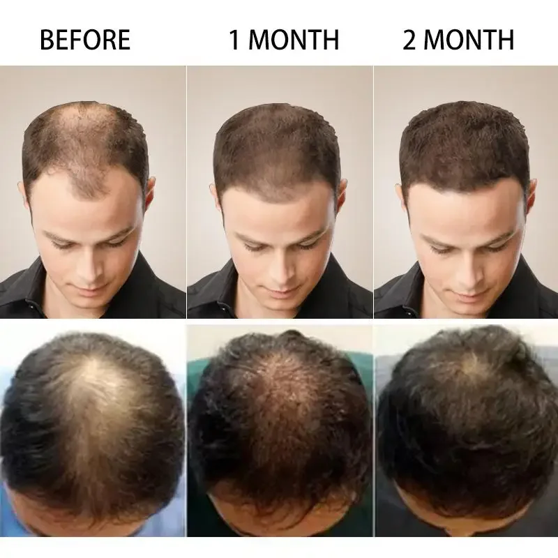 Hair Growth Ginger Fast Growin - огляд і ціна Coconut Oil Pull